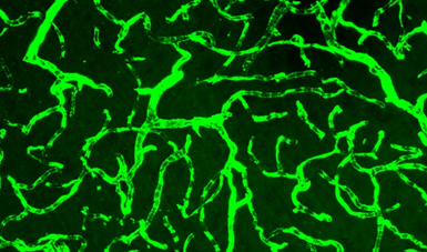 A photograph of blood vessels in the brain of an animal model of MS. They are green in this image because a green fluorescent dye was added, making capillaries visible under a microscope.